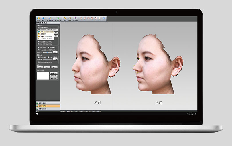效果評(píng)價(jià)