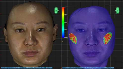 領智三維助力西安交大一附院整形美容頜面外科實現(xiàn)數(shù)字化微整形