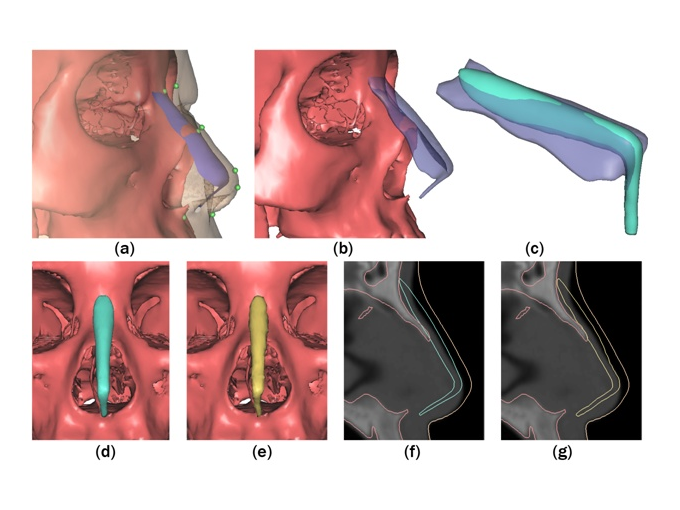 3D智能面部掃描儀