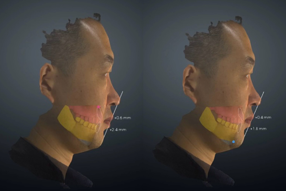 數(shù)字化技術(shù)賦能口腔正畸正頜，領(lǐng)智三維參展2024合肥口腔展